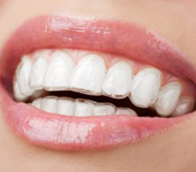 ortodonzia klinger